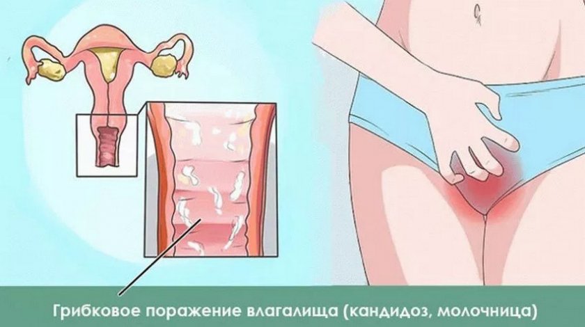 Клюква при молочнице Клюква при молочнице