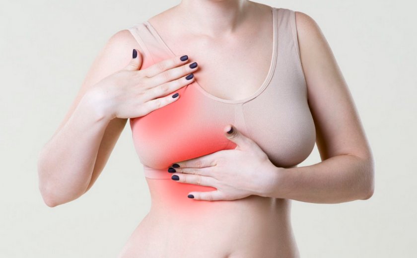 Трещины на женской груди