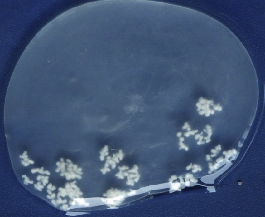 Міхур (кіста) зі сколексами