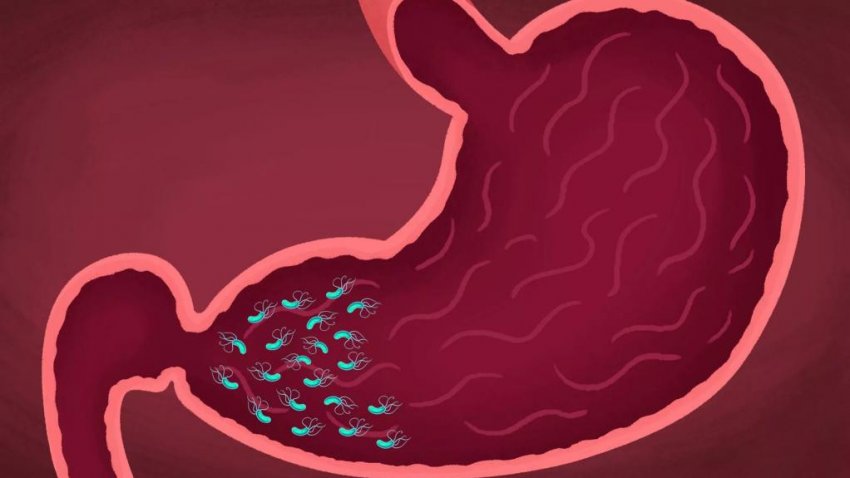 Журавлина при гастриті