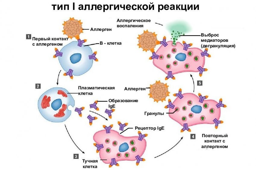 Первый тип аллергической реакции