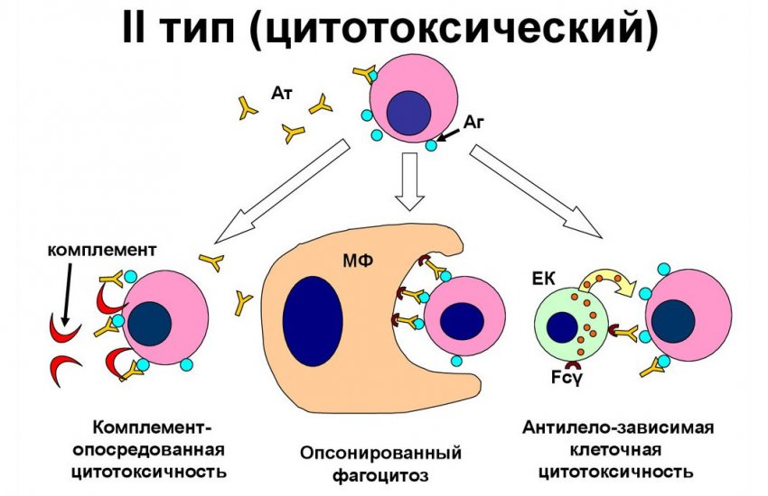 Второй тип аллергической реакции
