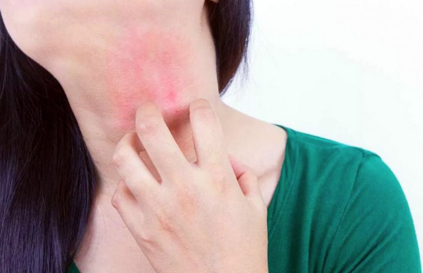 Симптомы аллергии на миндаль у взрослых