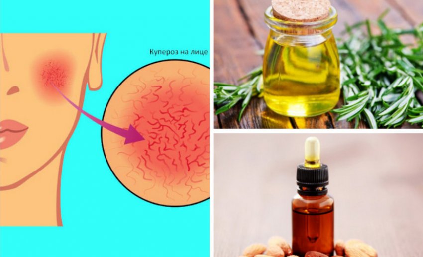 Олії проти судинної сітки