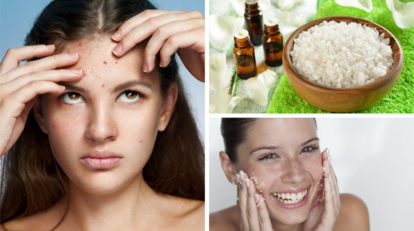 Скраб для усунення вугрової висипки