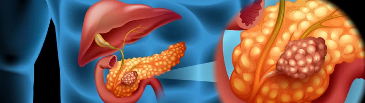 Чи можна вживати волоські горіхи при панкреатиті