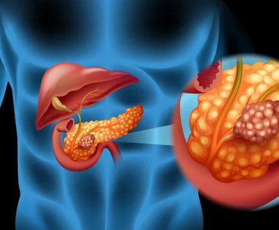 Чи можна вживати волоські горіхи при панкреатиті