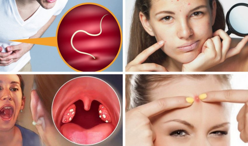 Показання до вживання відвару з листя