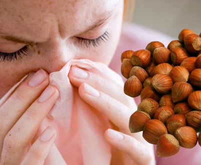 Лечение и профилактика аллергии на фундук