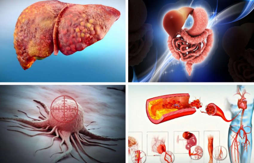 Показання для вживання грибів шиітаке Показання для вживання грибів шиітаке