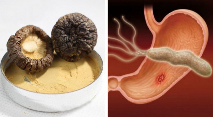 Порошок шиітаке при виразковій хворобі Порошок шиітаке при виразковій хворобі