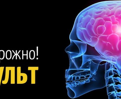Лікування інсульту сосновими шишками