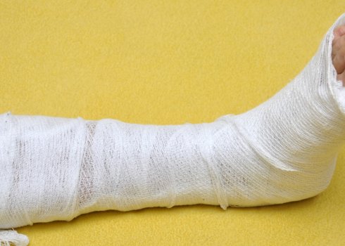 Применение пихтового масла при переломах ног