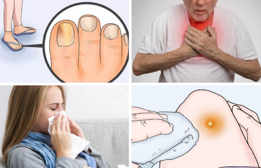 Ялицеве масло при хворобах