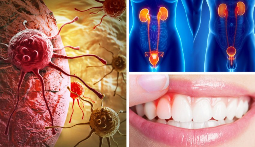 Показання до вживання варення Показання до вживання варення