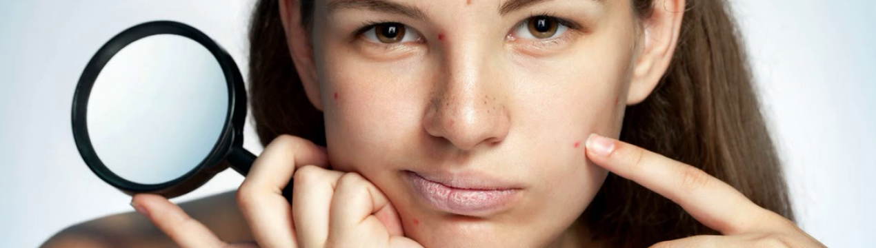 Масло обліпихове проти прищів