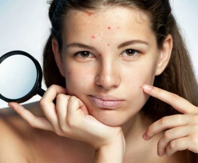 Масло обліпихове проти прищів