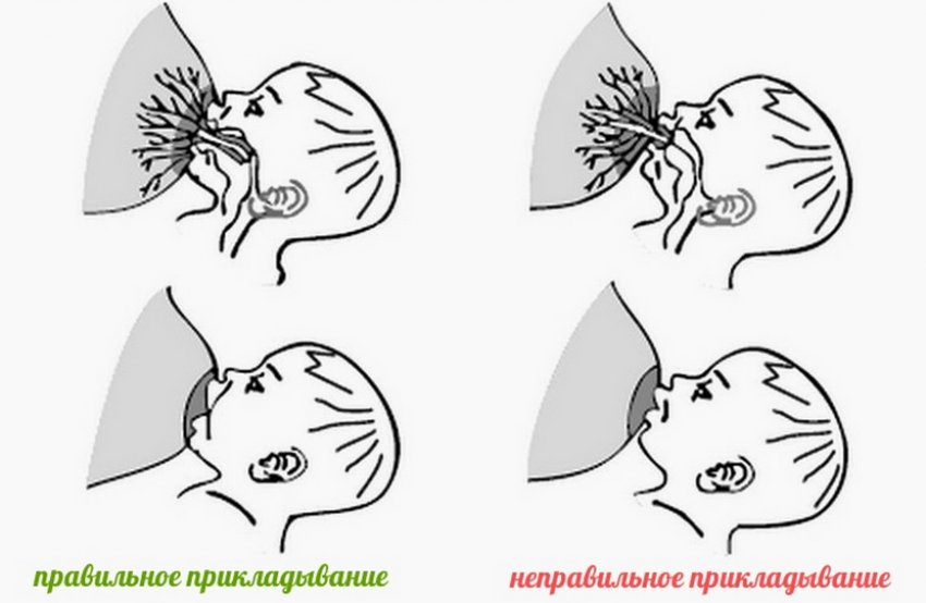 Правильне накладання до грудей