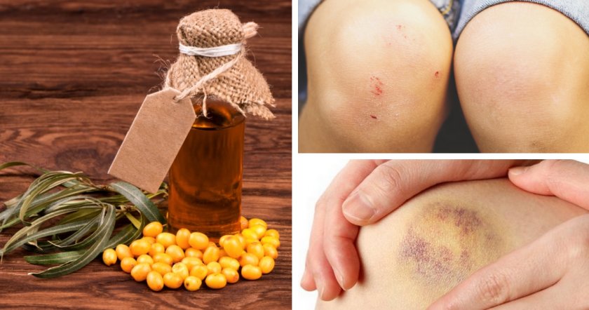 Применение масла при повреждениях кожи Применение масла при повреждениях кожи