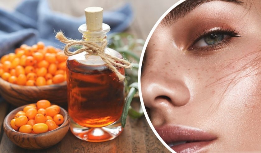 Облепиховое масло при проблемах с кожей Облепиховое масло при проблемах с кожей