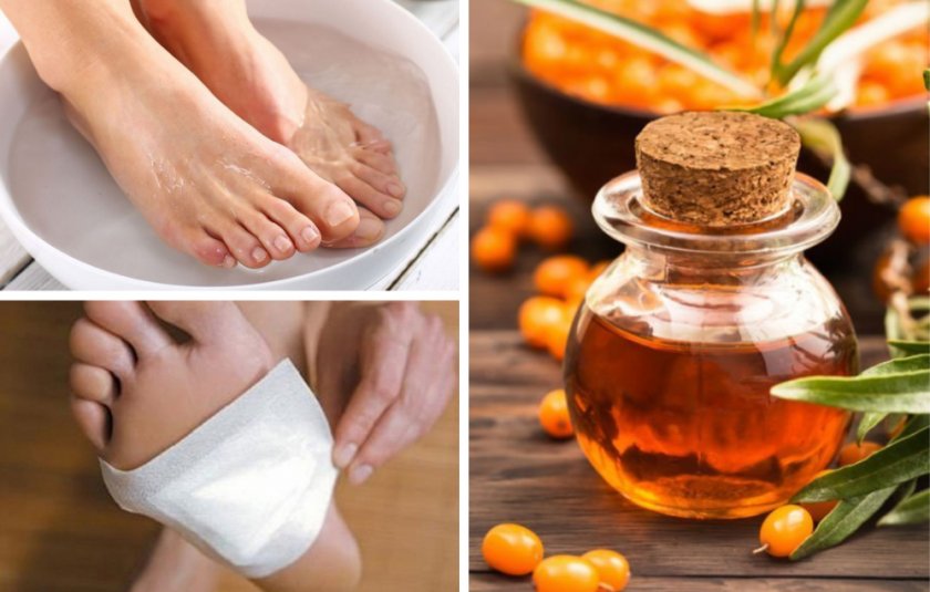 Облепиховое масло от мозолей Облепиховое масло от мозолей