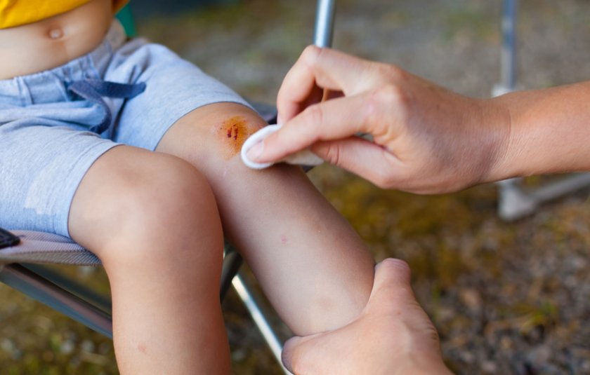 Протирание ссадины облепиховым маслом Протирание ссадины облепиховым маслом