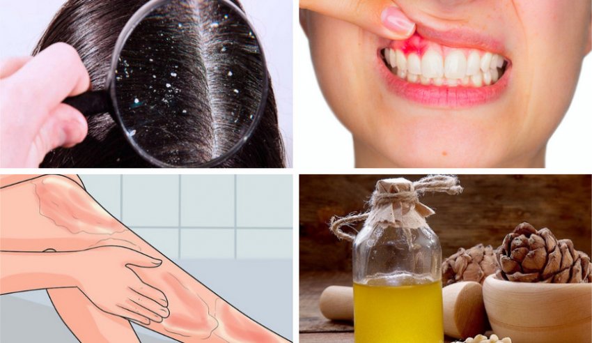 Використання кедрової олії Використання кедрової олії