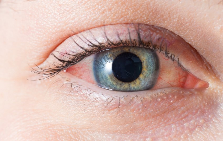 Смола кедра при захворюваннях очей Смола кедра при захворюваннях очей