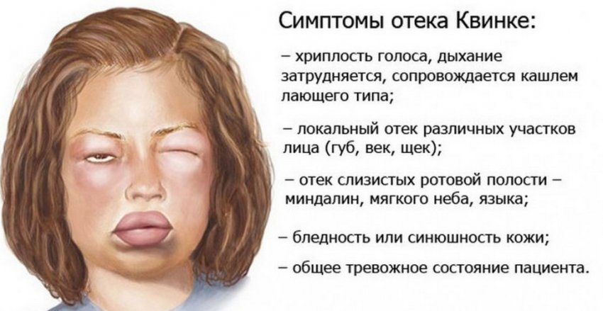 при фарингите можно облепиховое масло. 147243.q1bij0.850. при фарингите можно облепиховое масло фото. при фарингите можно облепиховое масло-147243.q1bij0.850. картинка при фарингите можно облепиховое масло. картинка 147243.q1bij0.850. Хронический фарингит – хроническое воспалительное заболевание слизистой оболочки глотки и ее лимфоидной ткани.