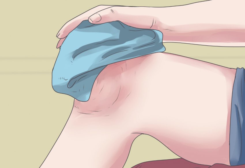 Компреси від синців та ударів Компреси від синців та ударів