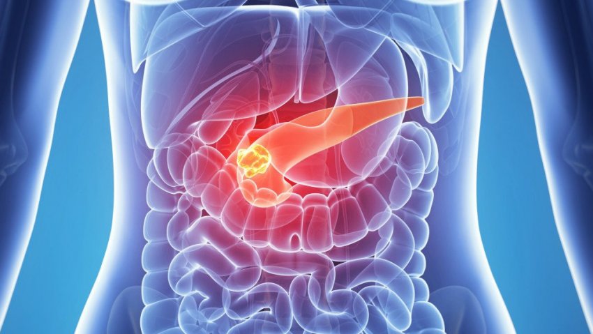 Гречка з кефіром при панкреатите