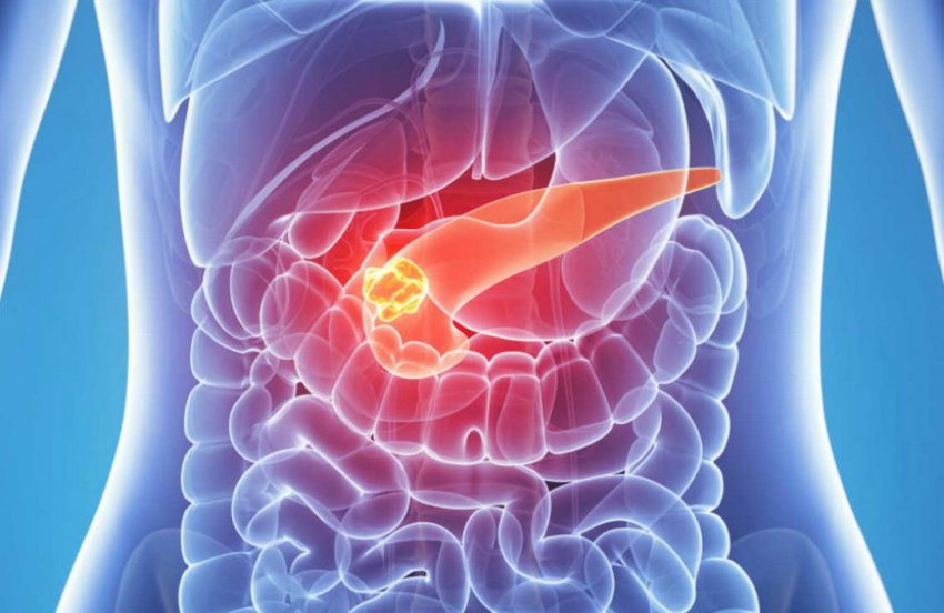 Панкреатит Панкреатит