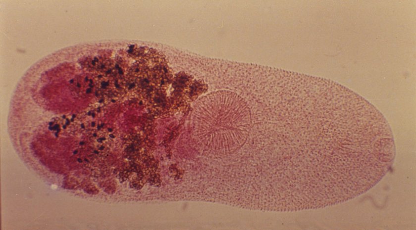 Трематода Metagonimus yokogawa под микроскопом