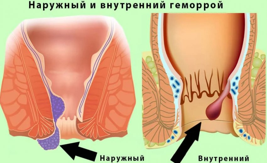 к какому семейству относится пшено. Смотреть фото к какому семейству относится пшено. Смотреть картинку к какому семейству относится пшено. Картинка про к какому семейству относится пшено. Фото к какому семейству относится пшено