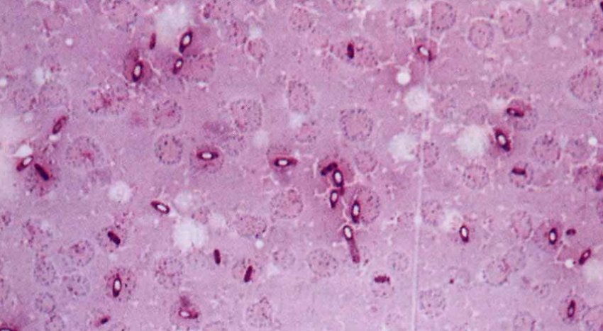 Clostridium chauvoei