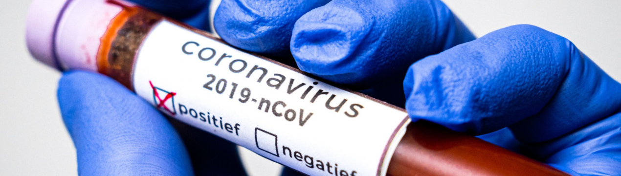 Согласно дослідженню, інтенсивне сільське господарство збільшує ризик пандемій