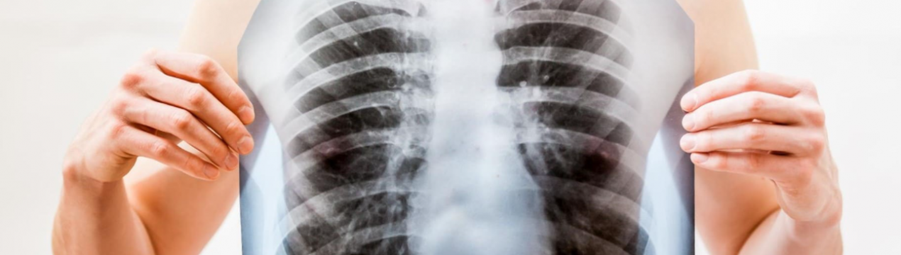 Учені визначили список продуктів, які допоможуть людині відновитися після коронавірусу