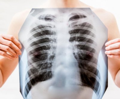 Учені визначили список продуктів, які допоможуть людині відновитися після коронавірусу