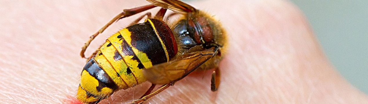 Надання першої допомоги при укусі оси в домашніх умовах