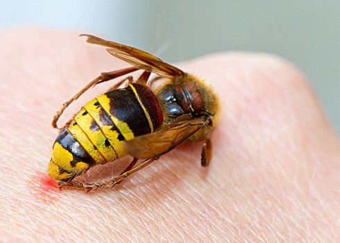 Надання першої допомоги при укусі оси в домашніх умовах