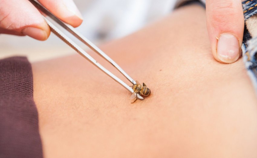 Апітерапія