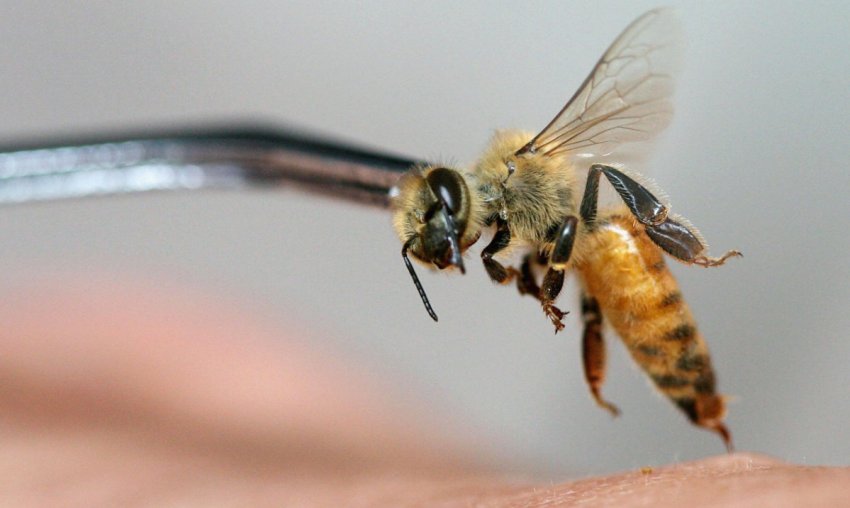 Апітерапія