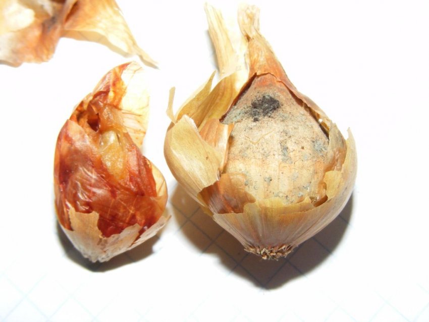 Аспергільоз Аспергільоз