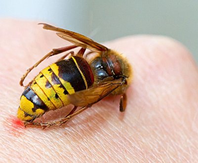 Ефективні способи для усунення набряку або пухлини після укусу бджоли