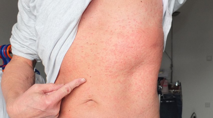 Шкоду вишні Шкоду вишні