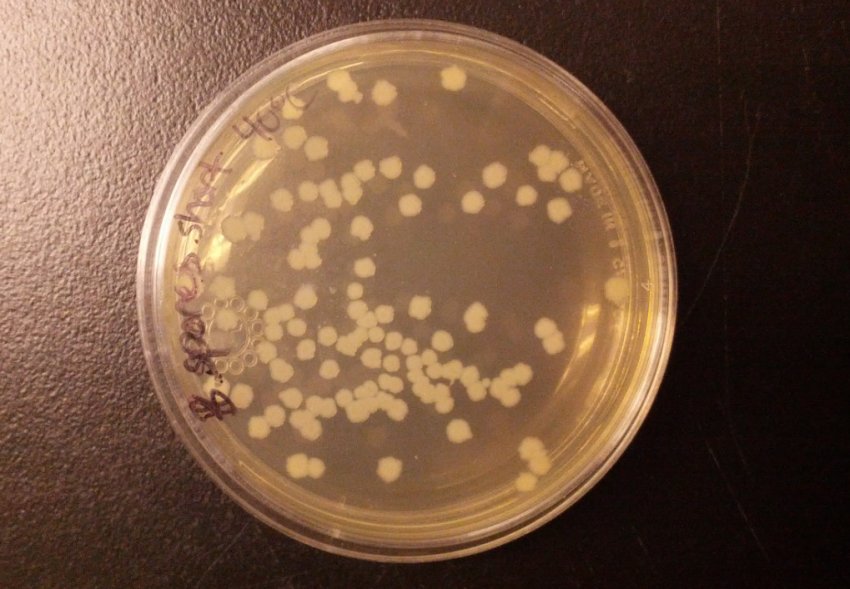 Сінна паличка