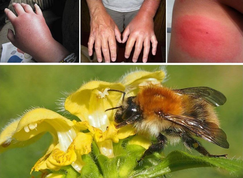 Укус джмеля Укус джмеля