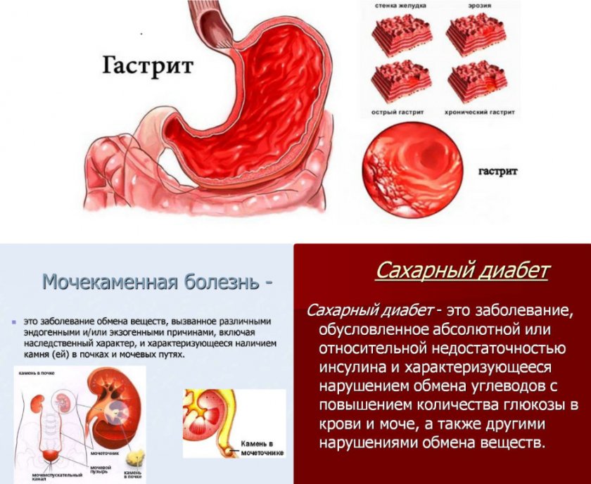 Заболевания при которых нельзя есть дыню Заболевания при которых нельзя есть дыню