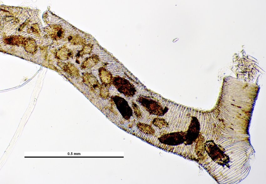 Акарозы в трахеї