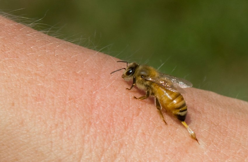 Пчелиный яд и дерматология